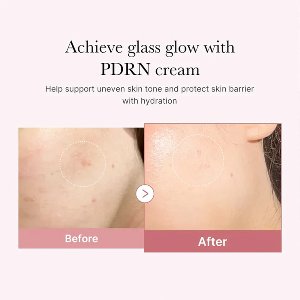 MEDICUBE - PDRN Pink Hyaluronic Moisturizing Cream 50ml